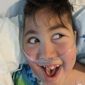 A close up on a boy's face. He is in a hospital bed with nasal cannulas for oxygen support. He has a very big smile.